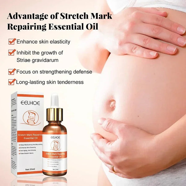 "Stretch Marks Repair Essential Oil"