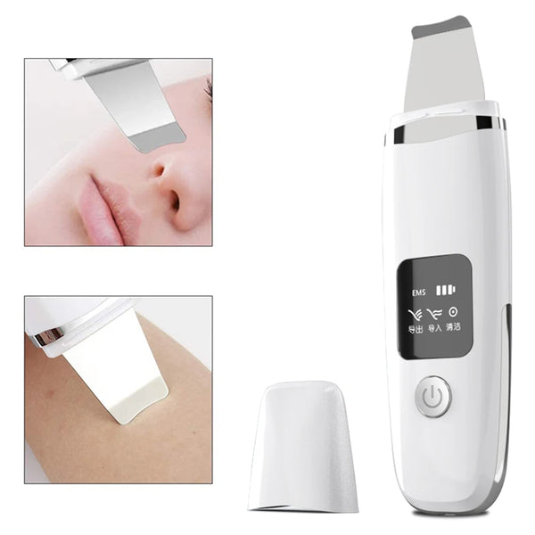 "Ultrasonic Skin Scrubber Blackhead Remover"